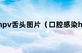 hpv感染者口腔里有hpv病毒吗 口腔hpv感染舌头的症状